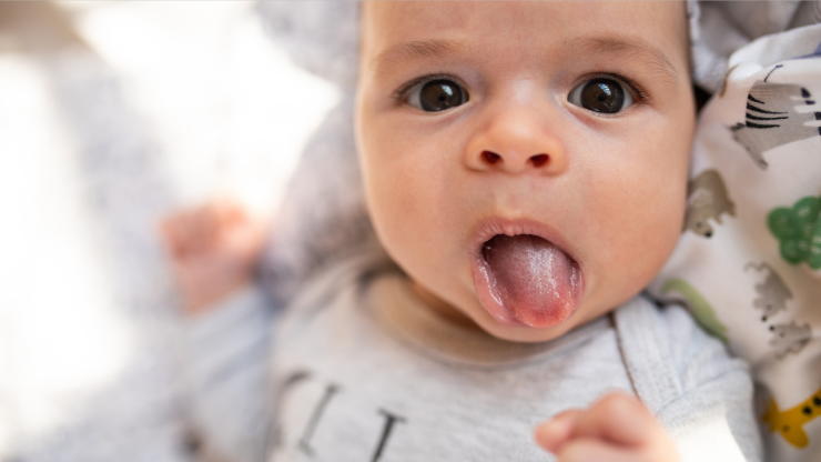 LactApp_Frenillo lingual corto ¿Cómo afecta a nuestra lactancia?